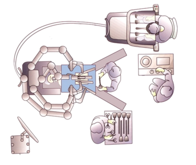 機(jī)器人手術(shù)已開展42000余例 醫(yī)生也要被取代